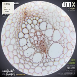 Haz vascular colateral cerrado